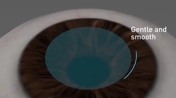 智能时尚激光近视手术 ATOS