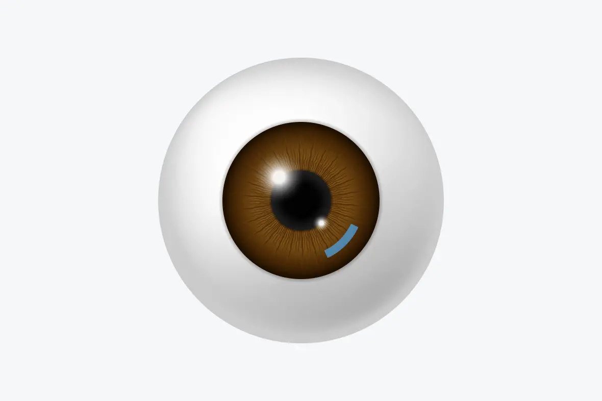 Нүдний болор цайх мэс засал