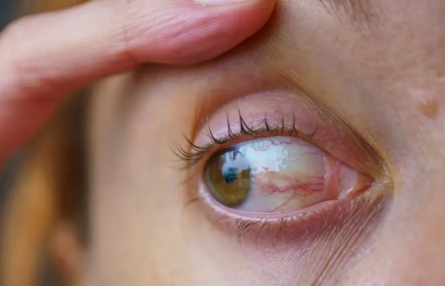 The Complete Essential Guide to Eye Diseases and Conditions in Gangnam Seoul